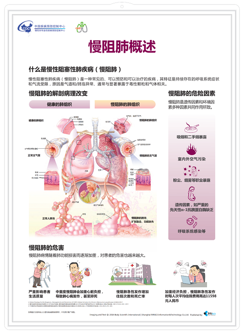 世界慢阻肺日| 慢阻肺概述 世界慢阻肺日| 慢阻肺概述
